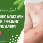 Understanding Monkeypox (mpox): Symptoms, Treatment, and Prevention