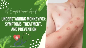 Read more about the article Understanding Monkeypox (mpox): Symptoms, Treatment, and Prevention