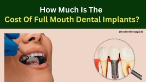 Read more about the article How Much Is The Cost Of Full Mouth Dental Implants?